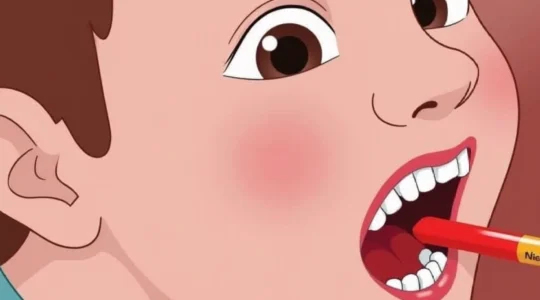 bleeding-10-days-after-tonsillectomy-what-it-means