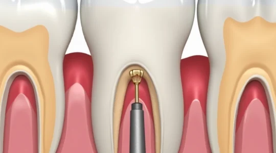 what-a-bruised-tooth-looks-like