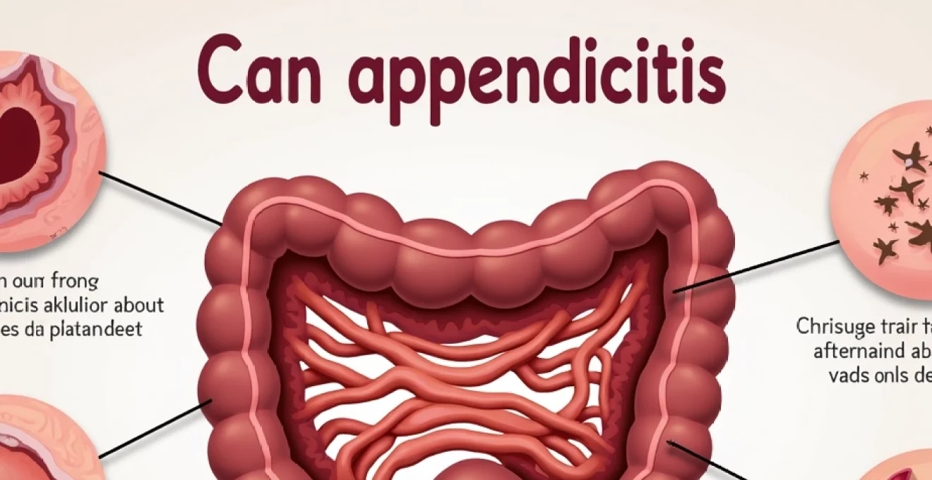 can-appendicitis-resolve-on-its-own